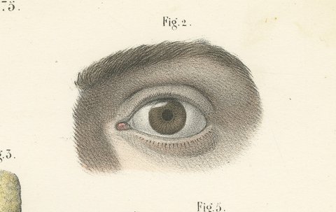 The Eyelids and Lacrimal Gland, Antique Hirschfeld Anatomy Print, 1866, view 4