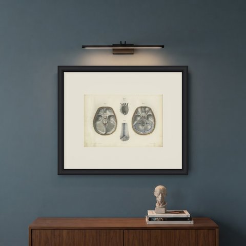 The Base of the Skull and Its Dural Folds, Hirschfeld Anatomy Print, 1866, shown framed on a wall