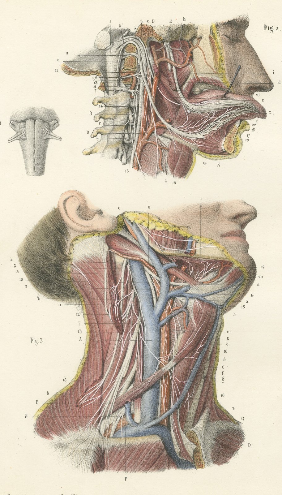 Nerves of the Neck, Antique Hirschfeld Anatomy Print, 1866