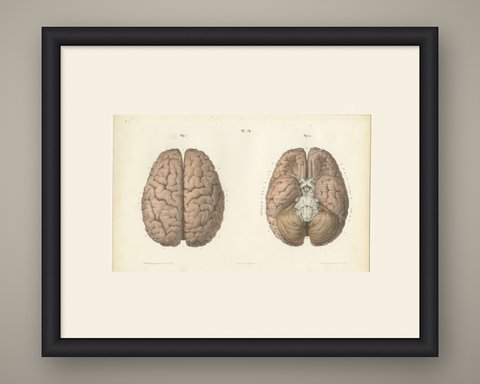 The Whole Brain from Above and Below, Antique Hirschfeld Anatomy Print, 1866, shown framed