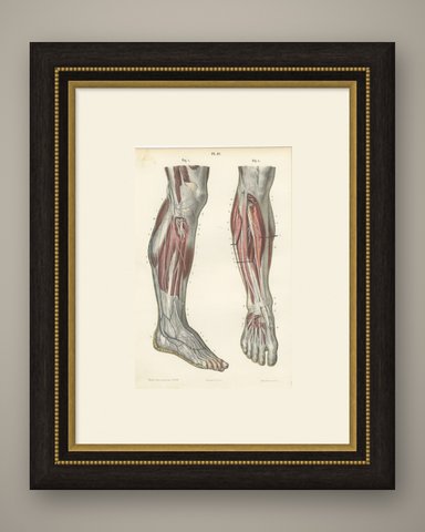 The Peroneal Nerves of the Leg, Antique Hirschfeld Anatomy Print, 1866, shown framed