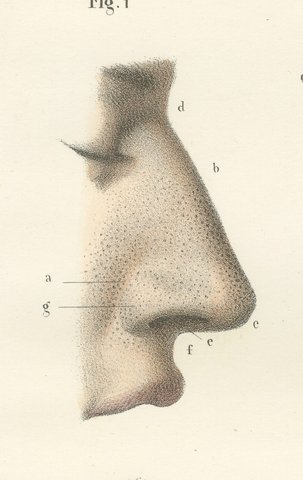 The External Nose and Its Cartilages, Antique Hirschfeld Anatomy Print, 1866, view 5