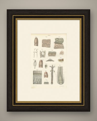 The Skin, Nail and Hair Follicle, Antique Hirschfeld Anatomy Print, 1866, shown framed