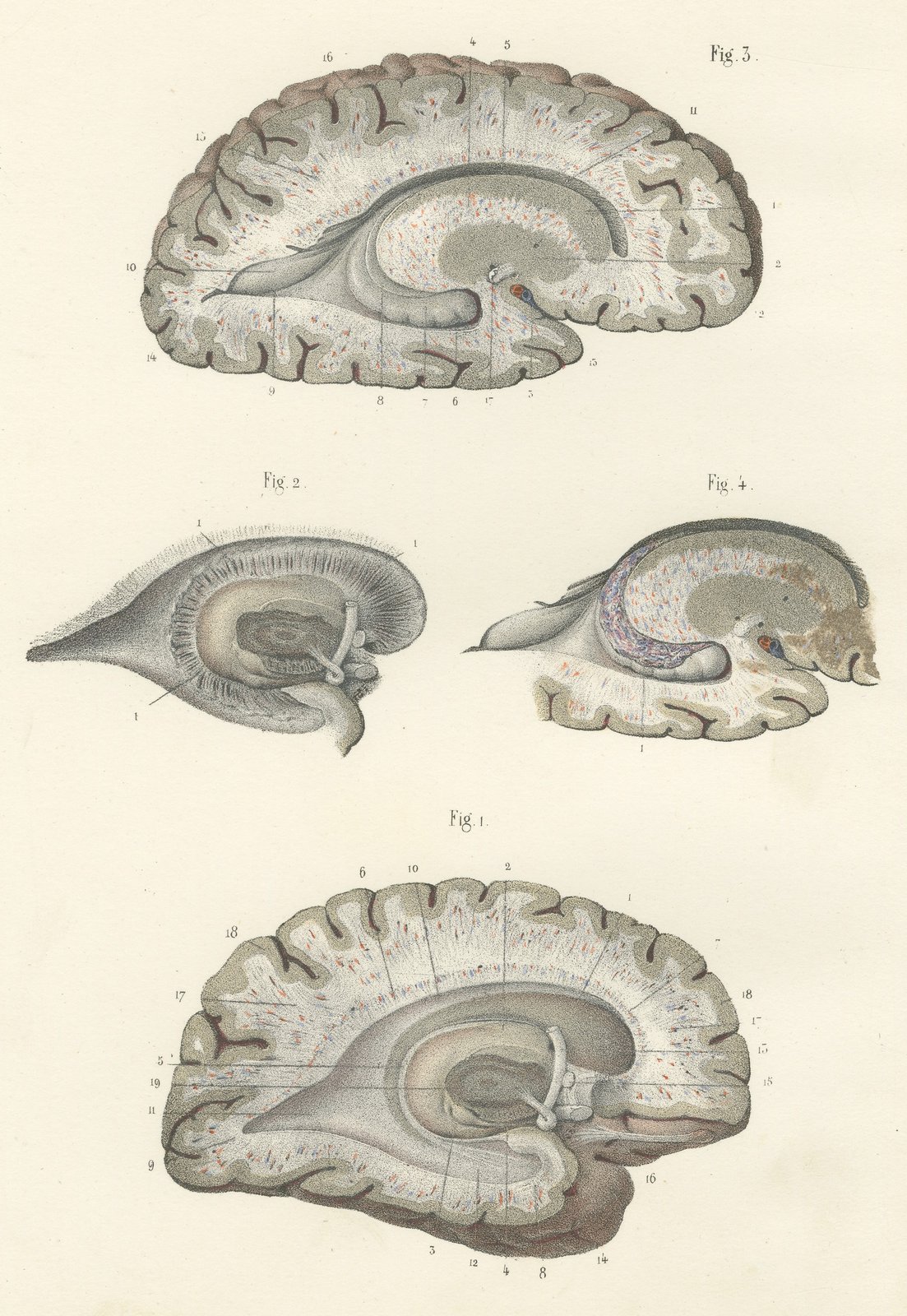 White Matter of the Cerebral Hemisphere, Antique Hirschfeld Anatomy Print, 1866