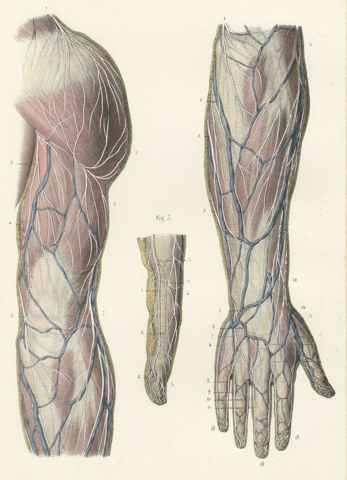Nerves of the Back of the Arm and Hand, Antique Hirschfeld Anatomy Print, 1866