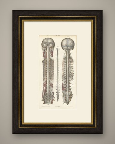 Brain and Spinal Cord in Situ, Hirschfeld Double Folding Plate, 1866, shown framed
