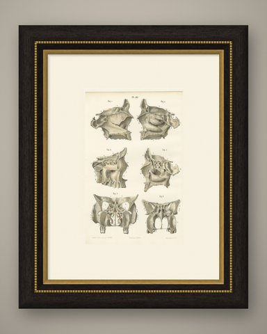 The Bony Nasal Cavity, Antique Hirschfeld Anatomy Print, 1866, shown framed