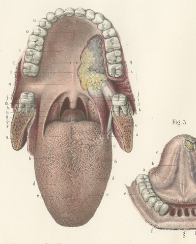 The Mouth, Tongue and Salivary Glands, Antique Hirschfeld Anatomy Print, 1866, view 3