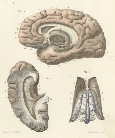 The Fornix and Choroid Plexus, Antique Hirschfeld Anatomy Print, 1866, view 4