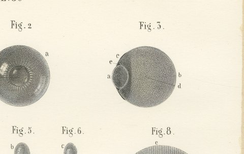 The Crystalline Lens, Antique Hirschfeld Anatomy Print, 1866, view 3
