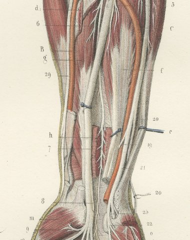 The Humerus and the Nerve Trunks of the Arm, Hirschfeld Anatomy Print, 1866, view 6