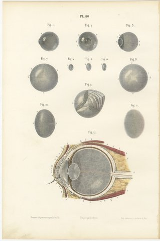 The Crystalline Lens, Antique Hirschfeld Anatomy Print, 1866, view 2