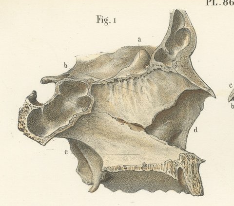 The Bony Nasal Cavity, Antique Hirschfeld Anatomy Print, 1866, view 3