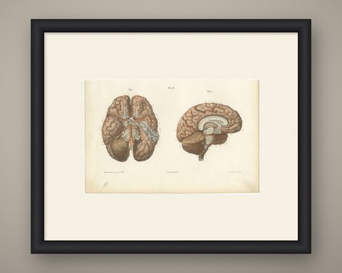 Arteries of the Brain, Antique Hirschfeld Anatomy Print, 1866, shown framed
