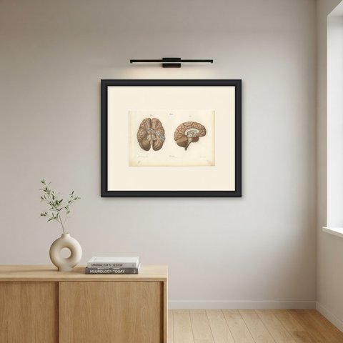 Arteries of the Brain, Antique Hirschfeld Anatomy Print, 1866, shown framed on a wall
