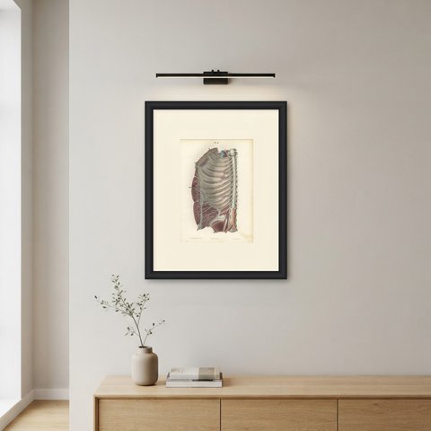 The Intercostal Nerves and Spinal Ganglia, Hirschfeld Anatomy Print, 1866, shown framed on a wall