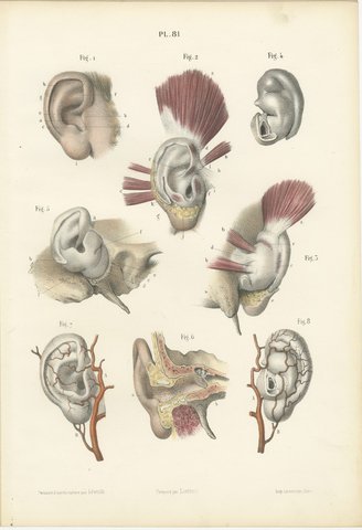 The External Ear, Antique Hirschfeld Anatomy Print, 1866, view 2