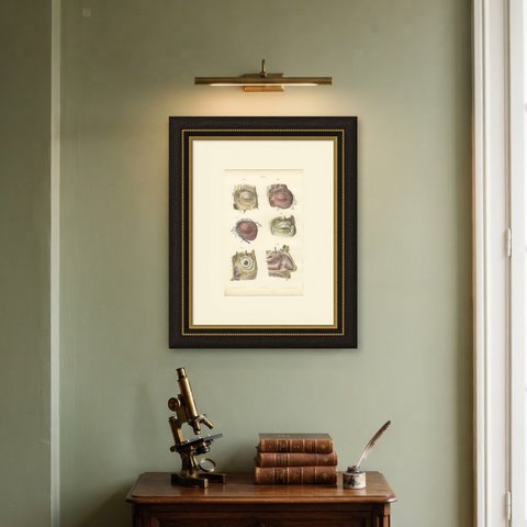 Vessels of the Eyelids and Orbit, Antique Hirschfeld Anatomy Print, 1866, shown framed on a wall