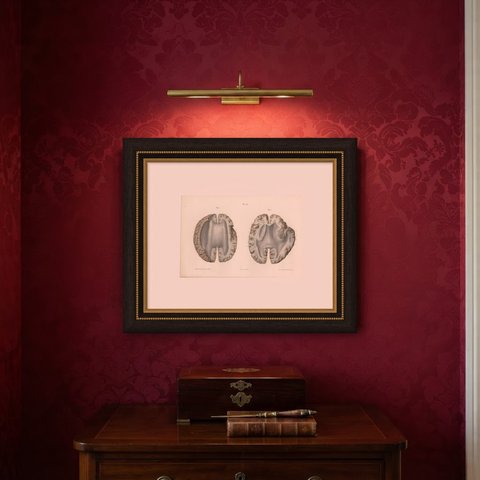 Horizontal Sections of the Cerebrum, Antique Hirschfeld Anatomy Print, 1866, shown framed on a wall