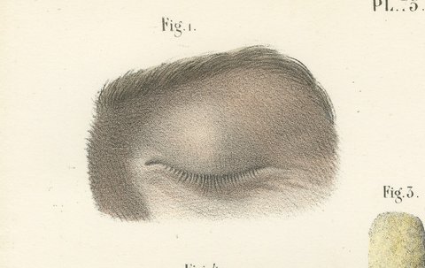 The Eyelids and Lacrimal Gland, Antique Hirschfeld Anatomy Print, 1866, view 3