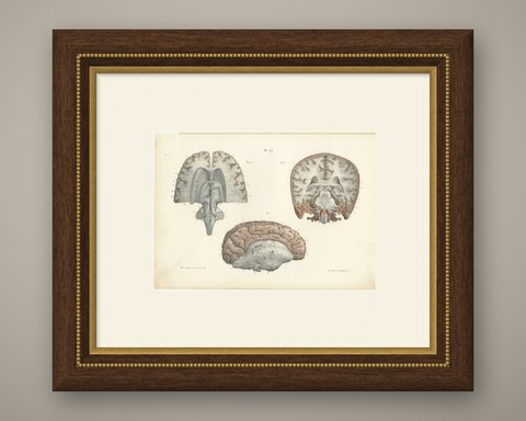 Coronal Section of the Head, Antique Hirschfeld Anatomy Print, 1866, shown framed