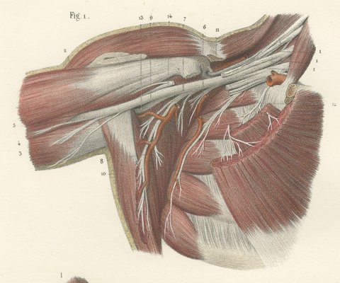 The Axilla and the Cords of the Plexus, Antique Hirschfeld Anatomy Print, 1866, view 3