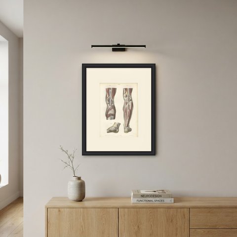 The Popliteal Region and the Calf, Antique Hirschfeld Anatomy Print, 1866, shown framed on a wall