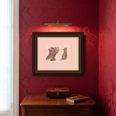 The Cervical Plexus, Antique Hirschfeld Anatomy Print, 1866, shown framed on a wall