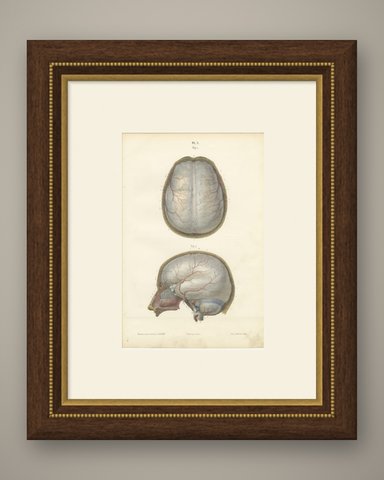 The Dura Mater of the Brain, Antique Hirschfeld Anatomy Print, 1866, shown framed
