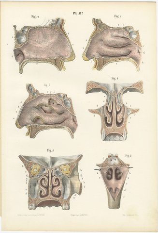The Lining Membrane of the Nose, Antique Hirschfeld Anatomy Print, 1866, view 2