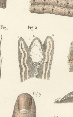The Skin, Nail and Hair Follicle, Antique Hirschfeld Anatomy Print, 1866, view 6