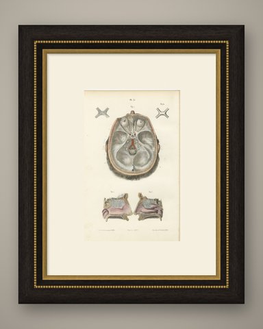The Olfactory Nerves and Optic Chiasm, Antique Hirschfeld Anatomy Print, 1866, shown framed