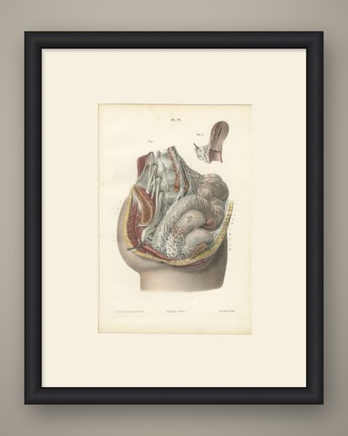 Nerves of the Male Pelvic Viscera, Antique Hirschfeld Anatomy Print, 1866, shown framed