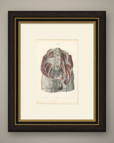 The Lumbar Plexus and the Groin, Antique Hirschfeld Anatomy Print, 1866, shown framed