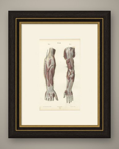 Nerves of the Whole Upper Limb, Antique Hirschfeld Anatomy Print, 1866, shown framed