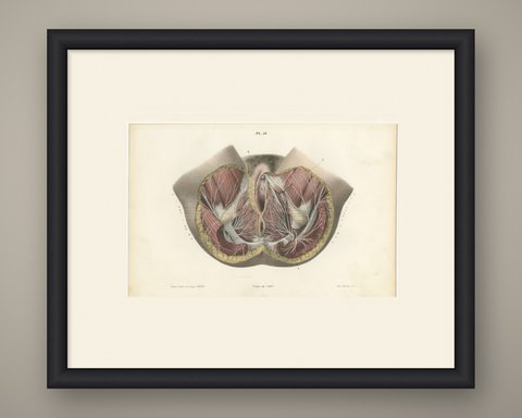 Nerves of the Female Perineum, Antique Hirschfeld Anatomy Print, 1866, shown framed