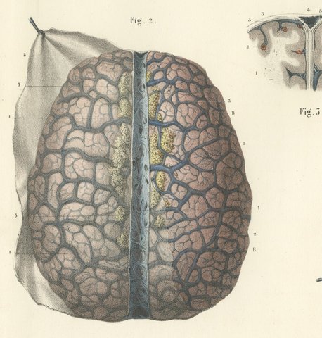 Veins of the Cerebral Hemispheres, Antique Hirschfeld Anatomy Print, 1866, view 3