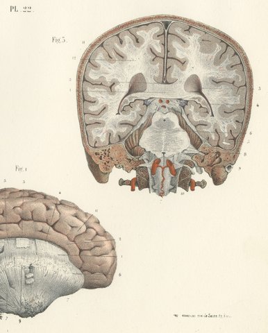 Coronal Section of the Head, Antique Hirschfeld Anatomy Print, 1866, view 4