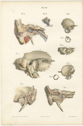 The Temporal Bone and Ear Canal, Antique Hirschfeld Anatomy Print, 1866, view 2