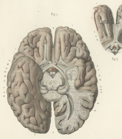 The Base of the Brain Dissected, Antique Hirschfeld Anatomy Print, 1866, view 3