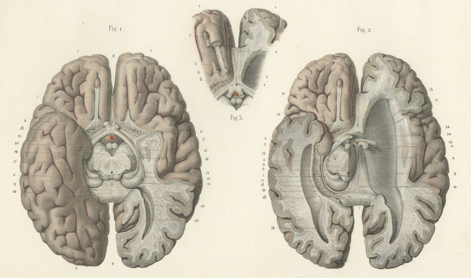 The Base of the Brain Dissected, Antique Hirschfeld Anatomy Print, 1866
