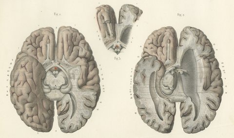 The Base of the Brain Dissected, Antique Hirschfeld Anatomy Print, 1866