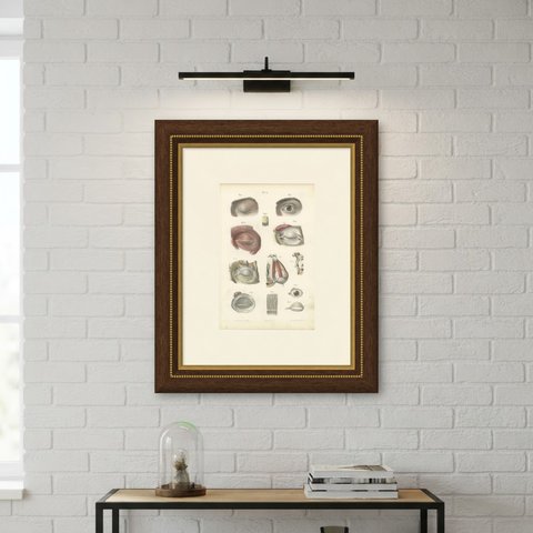 The Eyelids and Lacrimal Gland, Antique Hirschfeld Anatomy Print, 1866, shown framed on a wall