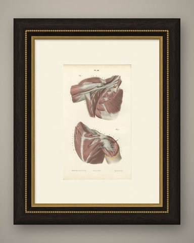 The Axilla and the Cords of the Plexus, Antique Hirschfeld Anatomy Print, 1866, shown framed