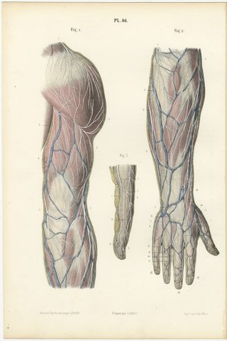 Nerves of the Back of the Arm and Hand, Antique Hirschfeld Anatomy Print, 1866, view 2