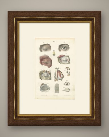 The Eyelids and Lacrimal Gland, Antique Hirschfeld Anatomy Print, 1866, shown framed