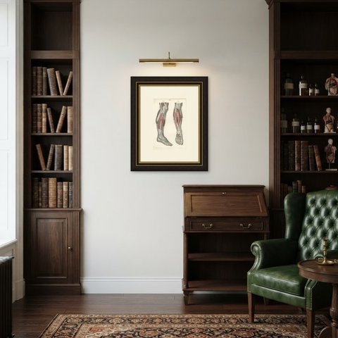 The Peroneal Nerves of the Leg, Antique Hirschfeld Anatomy Print, 1866, shown framed in a room