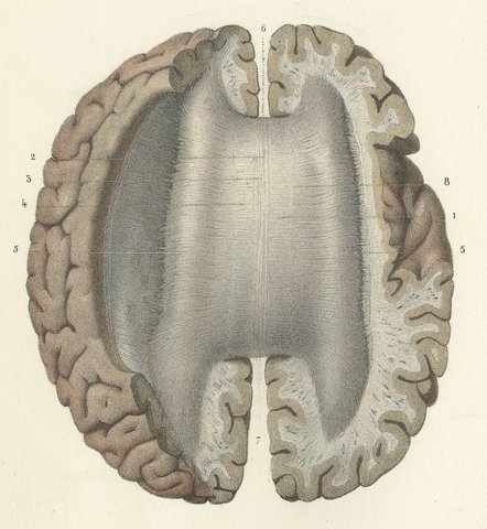 Horizontal Sections of the Cerebrum, Antique Hirschfeld Anatomy Print, 1866, view 3