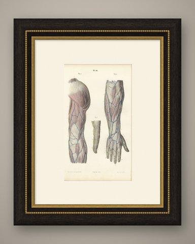 Nerves of the Back of the Arm and Hand, Antique Hirschfeld Anatomy Print, 1866, shown framed