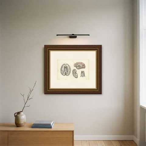 The Fornix and Choroid Plexus, Antique Hirschfeld Anatomy Print, 1866, shown framed on a wall